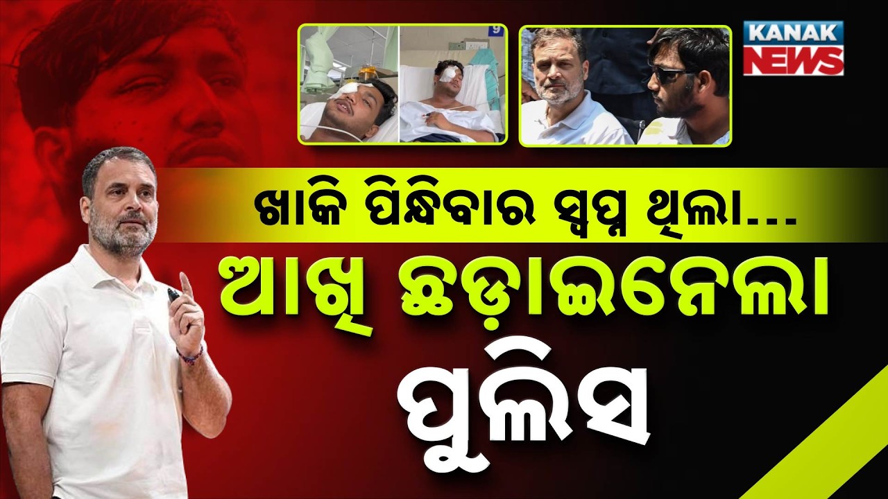 ପେଲେଟ୍&zwnj; ଛଡ଼ାଇନେଲା ସ୍ୱପ୍ନ! |Spl Report On Pellet Injury|Sahil&rsquo;s Police Dream Shattered,RahulSeeks FIR