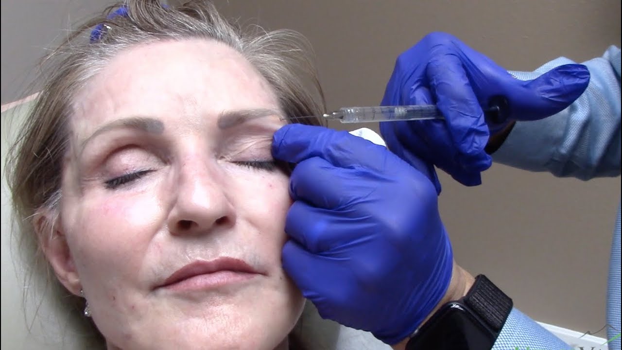 Sunken Eye Treatment | Utah Valley Dermatology