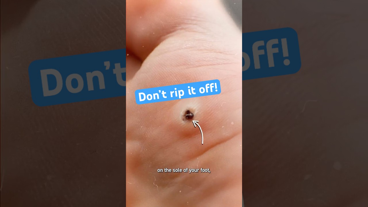 Nie odrywaj tego guza