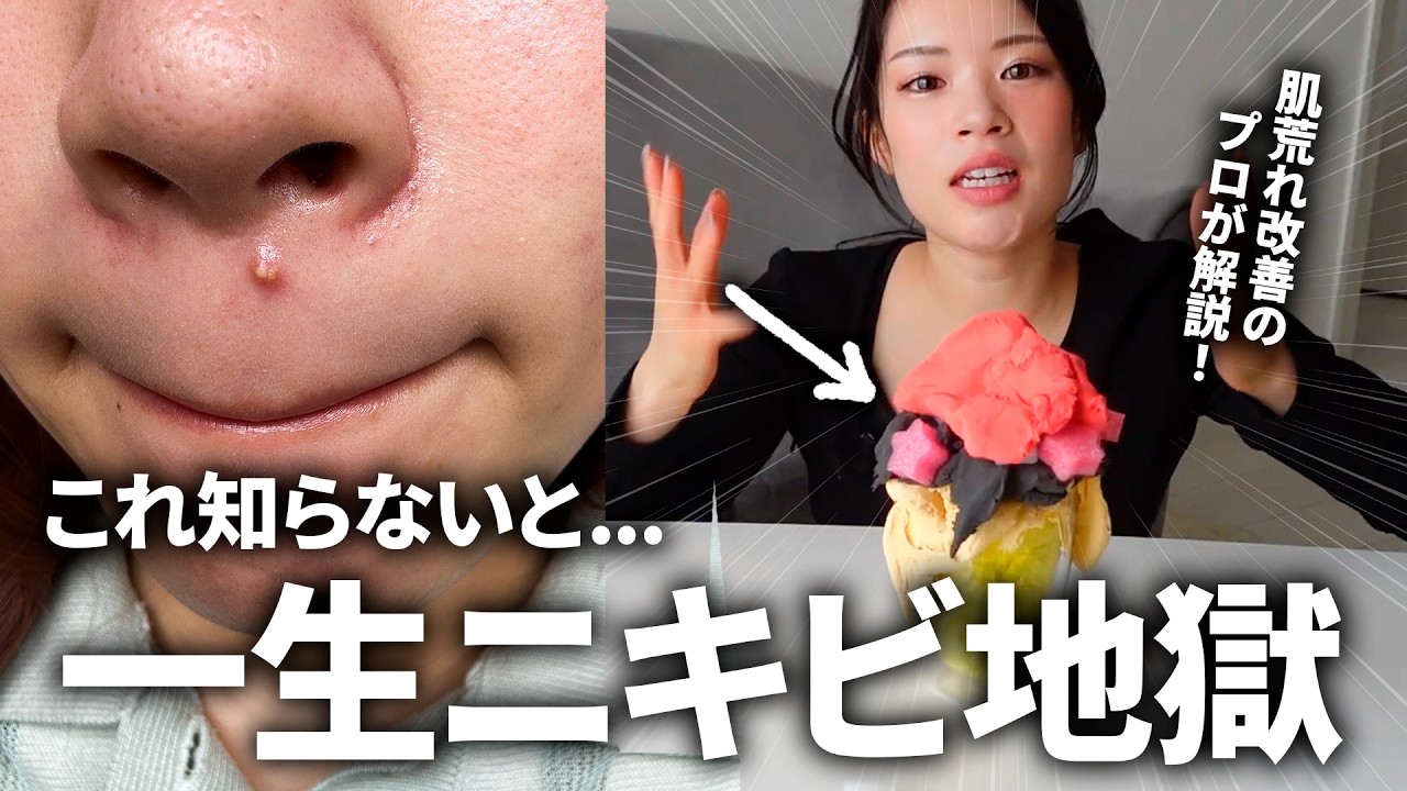 【肌荒れ】スキンケア頑張ってもニキビ治らない理由はこれ！ニキビの仕組み解説