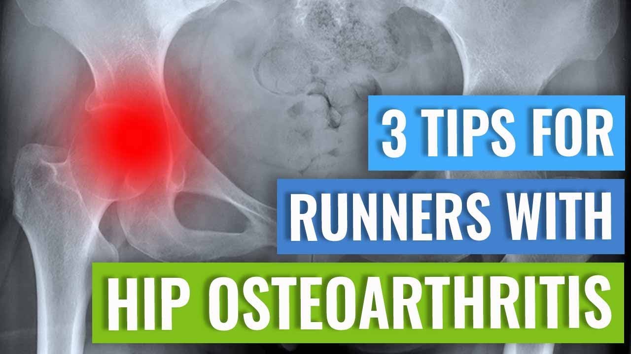 Hip Osteoarthritis - Tips for Runners
