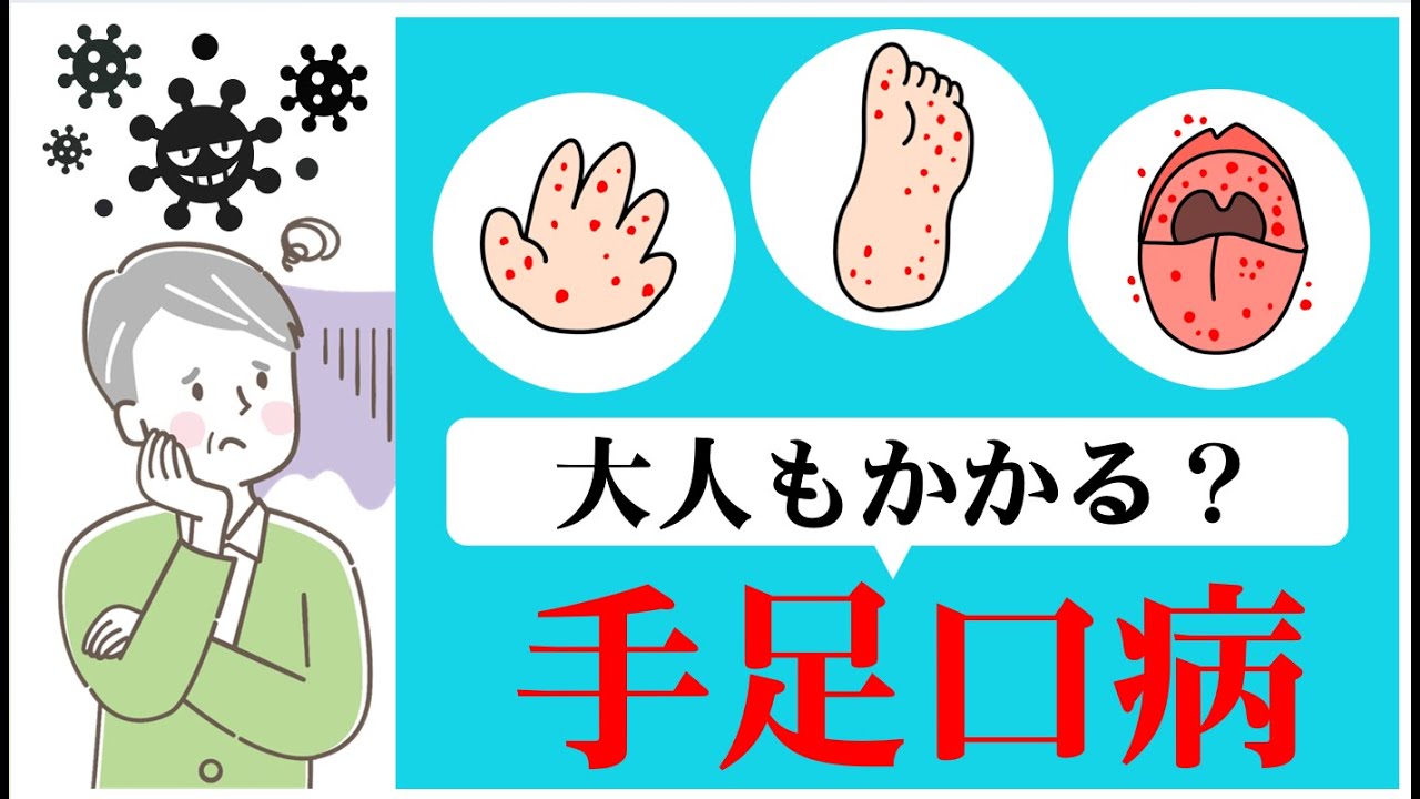 【手足口病】高齢者でも感染の可能性。症状や対策は？
