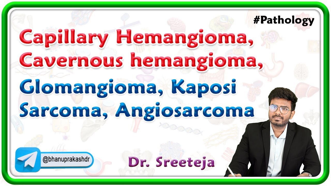 4. Capillary hemangioma, Cavernous hemangioma, Glomangioma, Kaposi sarcoma, Angiosarcoma : USMLE
