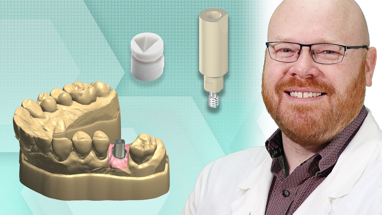 Sirona Implant Impressions