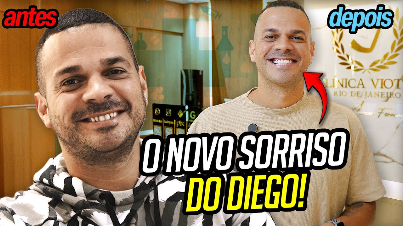 O SORRISO NOVO DO DIEGO