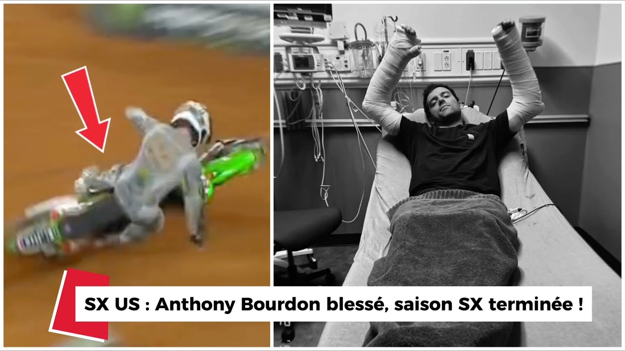 Blessure Anthony Bourdon 2026 : Fractures Poignets + Op&eacute;ration, Fin de Saison Supercross US !