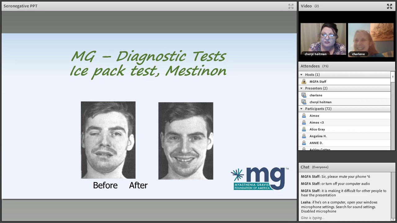 MGFA Webinar Series: Seronegative MG