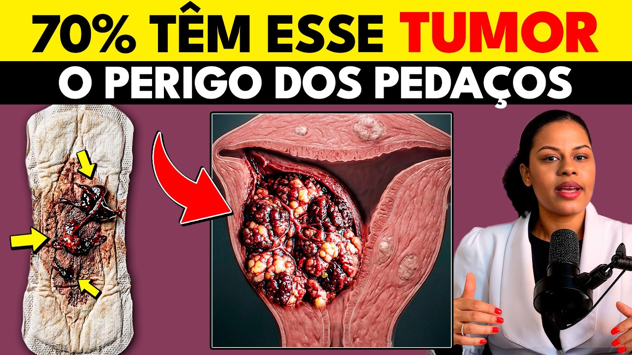 Pedaços na Menstruação NÃO é normal! 8 Causas PERIGOSAS que as mulheres ignoram