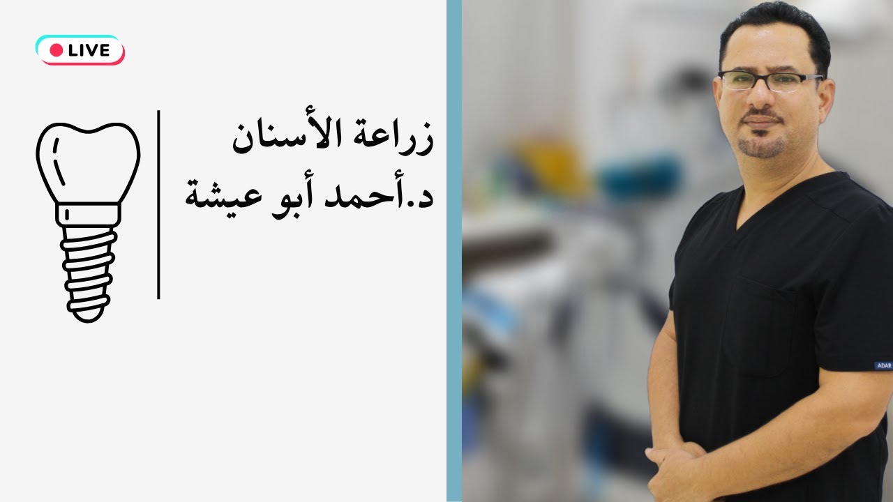 tiktok live الدكتور أحمد و المزيد عن زراعة الأسنان