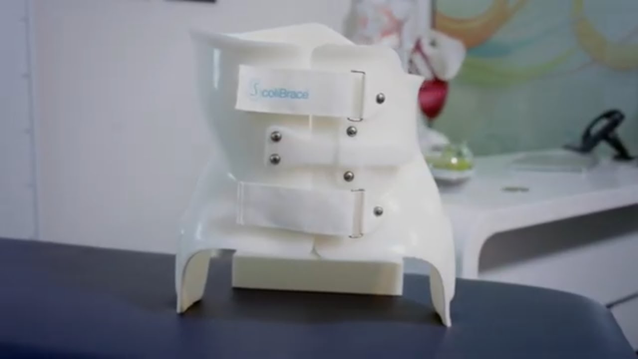 ScoliBrace Explained by ScoliCare | Dr. Walter Salubro ScoliBrace Provider in Vaughan ON