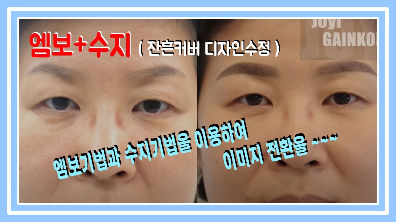 반영구화장