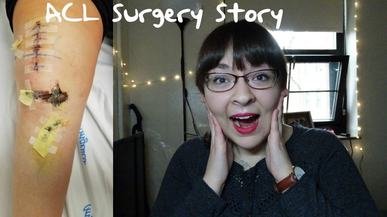 My ACL Surgery Experience: SURGERY, SCAR, PAIN, & PHYSICAL THERAPY