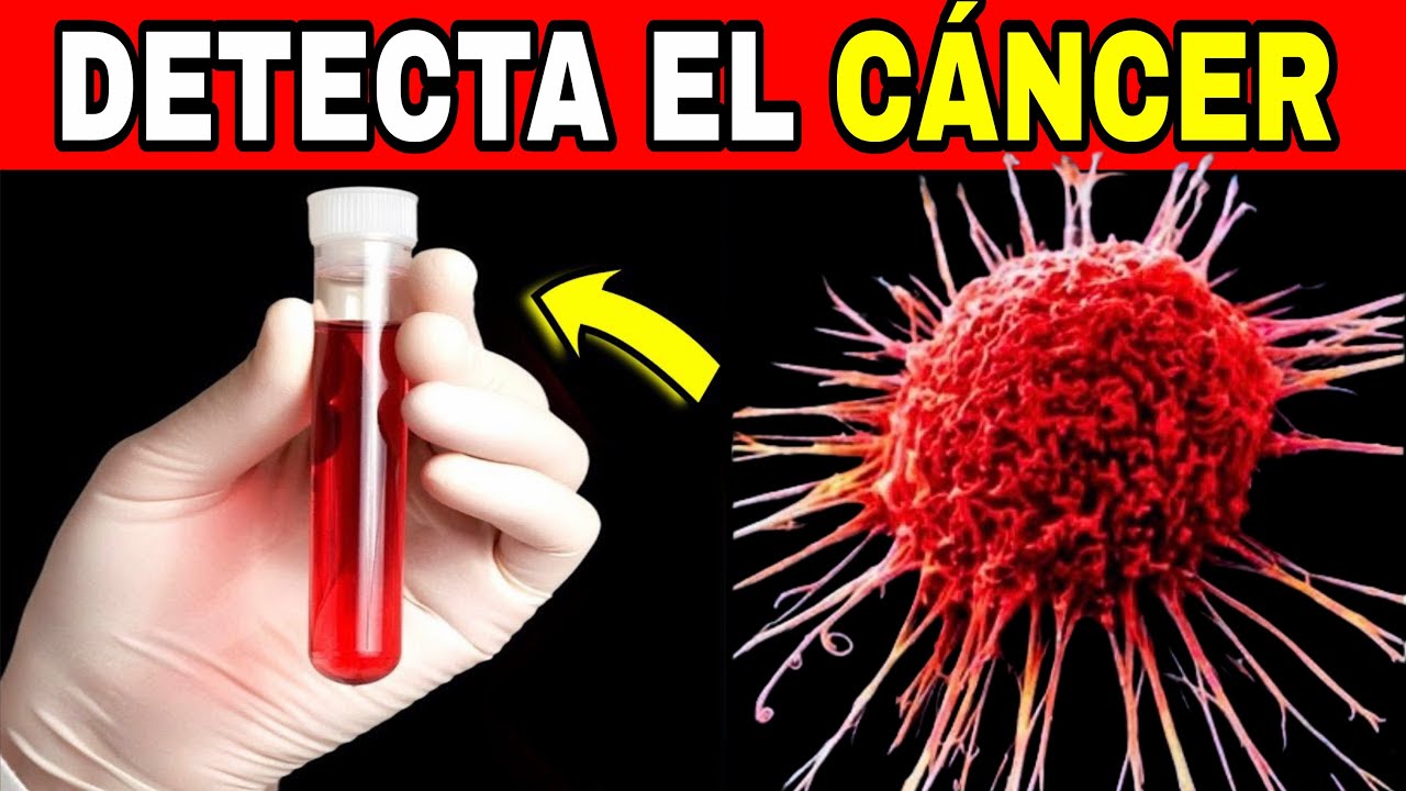 ¡ESTE EXAMEN MUESTRA SI TIENES CÁNCER! 7 Exámenes Que Pueden Salvar Tu Vida