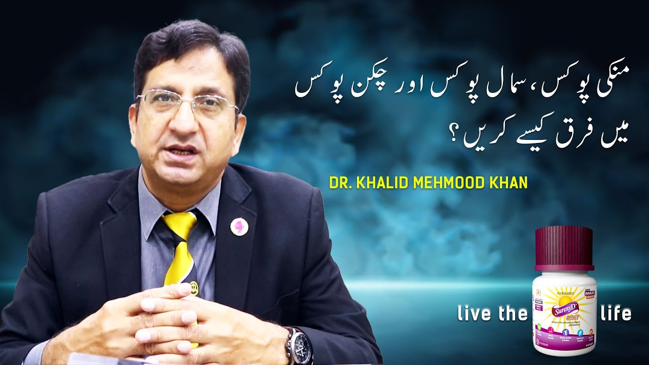 Difference between Smallpox, Chickenpox and Mpox - Dr. Khalid Mehmood