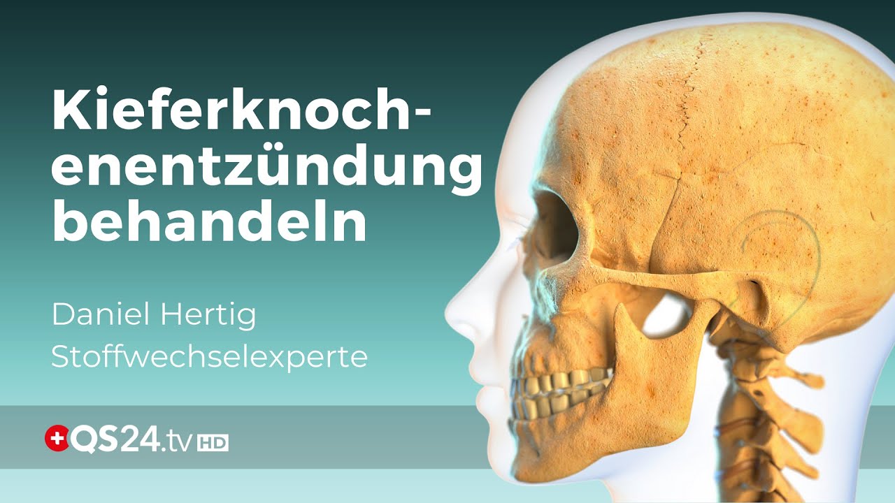 Was tun bei einer Kieferknochen-Entzündung? | Alternativmedizin | QS24 Gesundheitsfernsehen