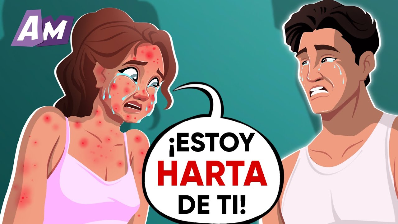 Me volví alérgica a mi marido
