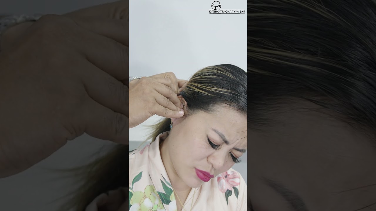 HOW TO PUT EAR DROPS THE RIGHT WAY