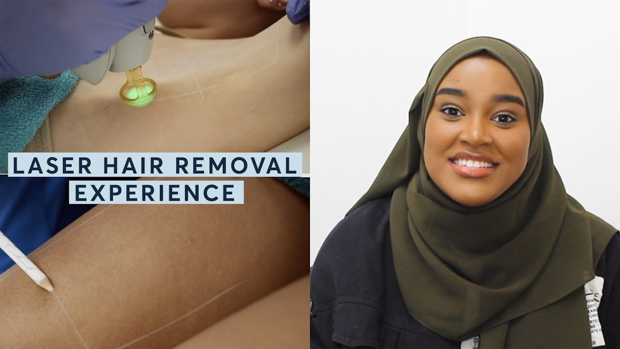 Laser Hair Removal for Dark Skin Types