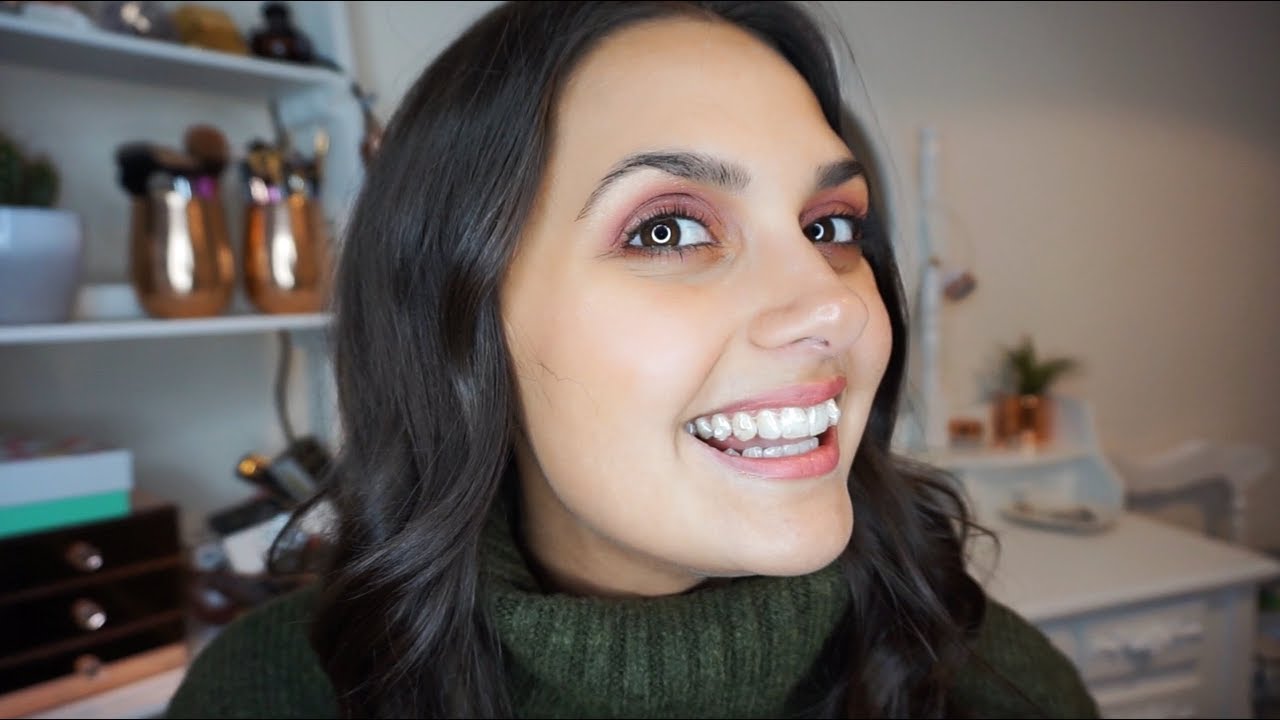 MY INVISALIGN JOURNEY #2 ▸ Getting my first tray fitted