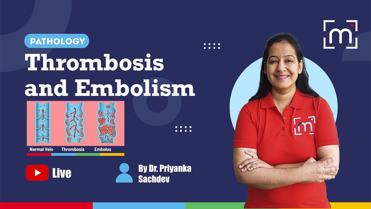 Thrombosis and Embolism with Dr. Priyanka Sachdev