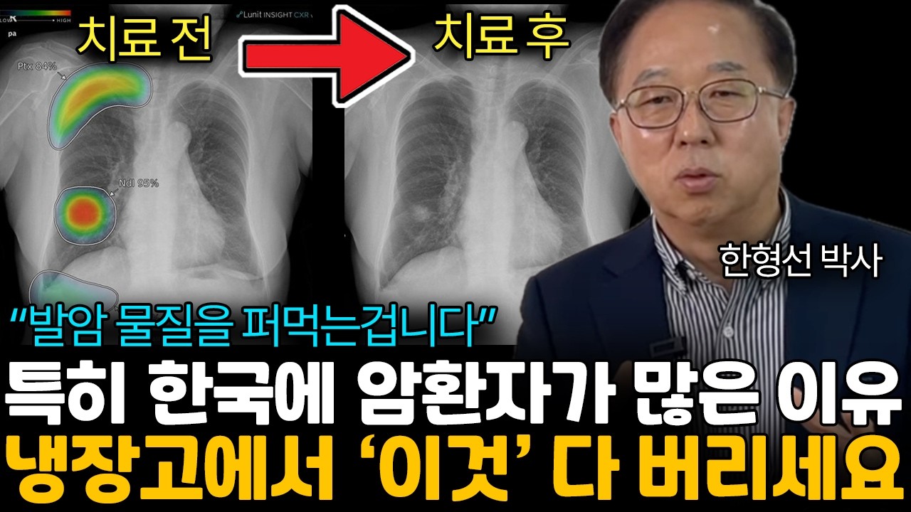 의사들이 입에도 안 대는 발암 음식! / 평생 암 안 걸리는 습관은 이것 뿐입니다. 항암 효과 식습관 (한형선 박사님 / 통합 2부)