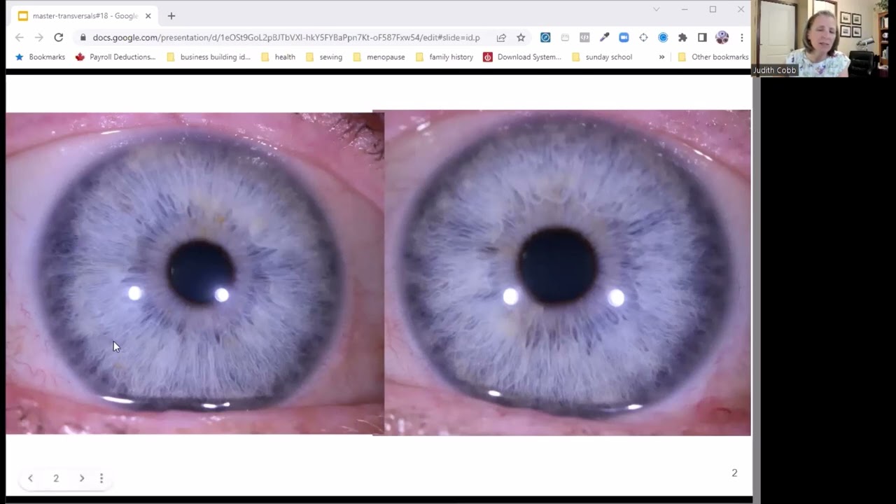 [Iridology] Transversals