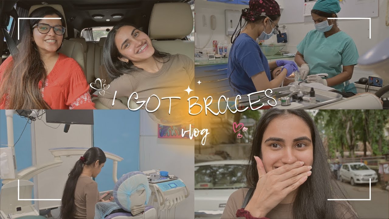 I GOT BRACES😳🙈✨ #vlog