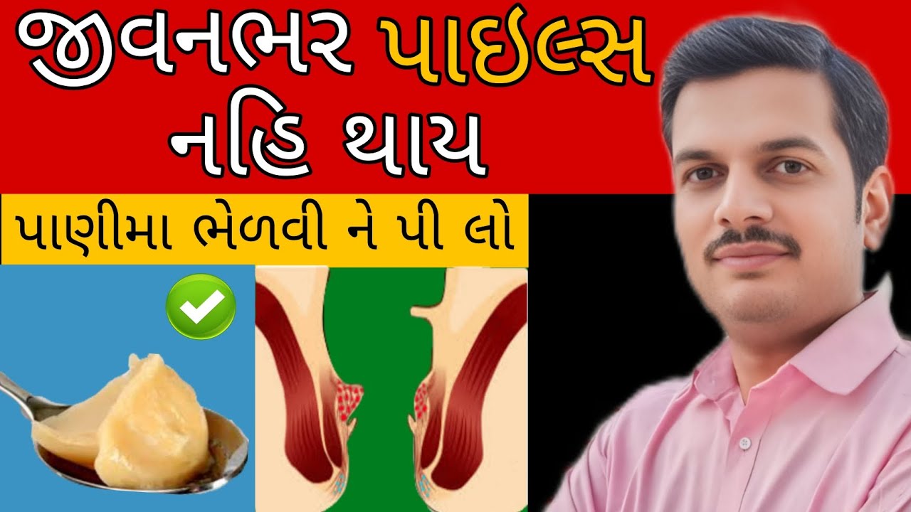 પાઇલ્સથી બચવાનો શ્રેષ્ઠ ઉપાય | best homeremedy for treatment of piles 