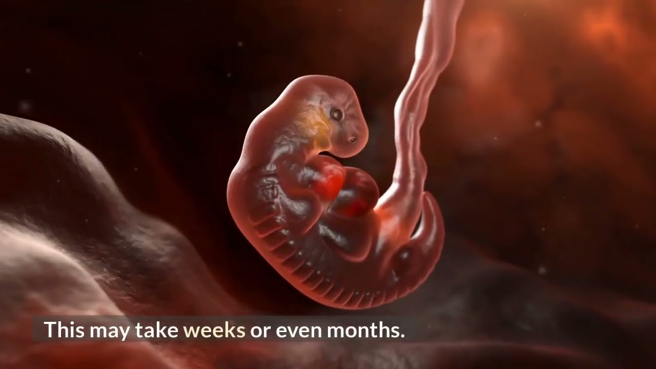 Flood Damage Clean Up - Water Damage Restoration Team