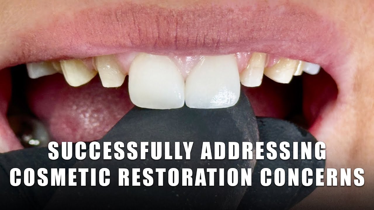 Successfully Addressing Cosmetic Restoration Concerns