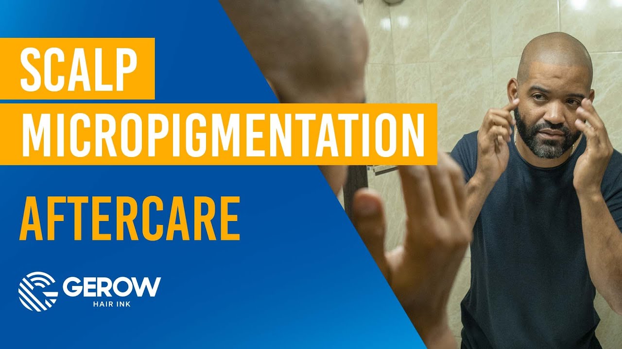 SCALP MICROPIGMENTATION AFTERCARE