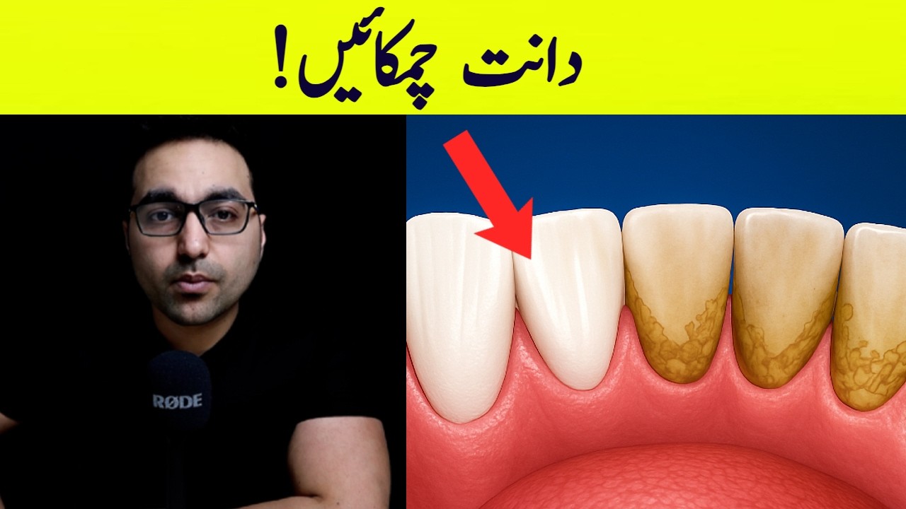 Daanton Ki Chamak Wapas Laaen! | No.1 BEST Remedy for Dental Plaque (TARTAR)