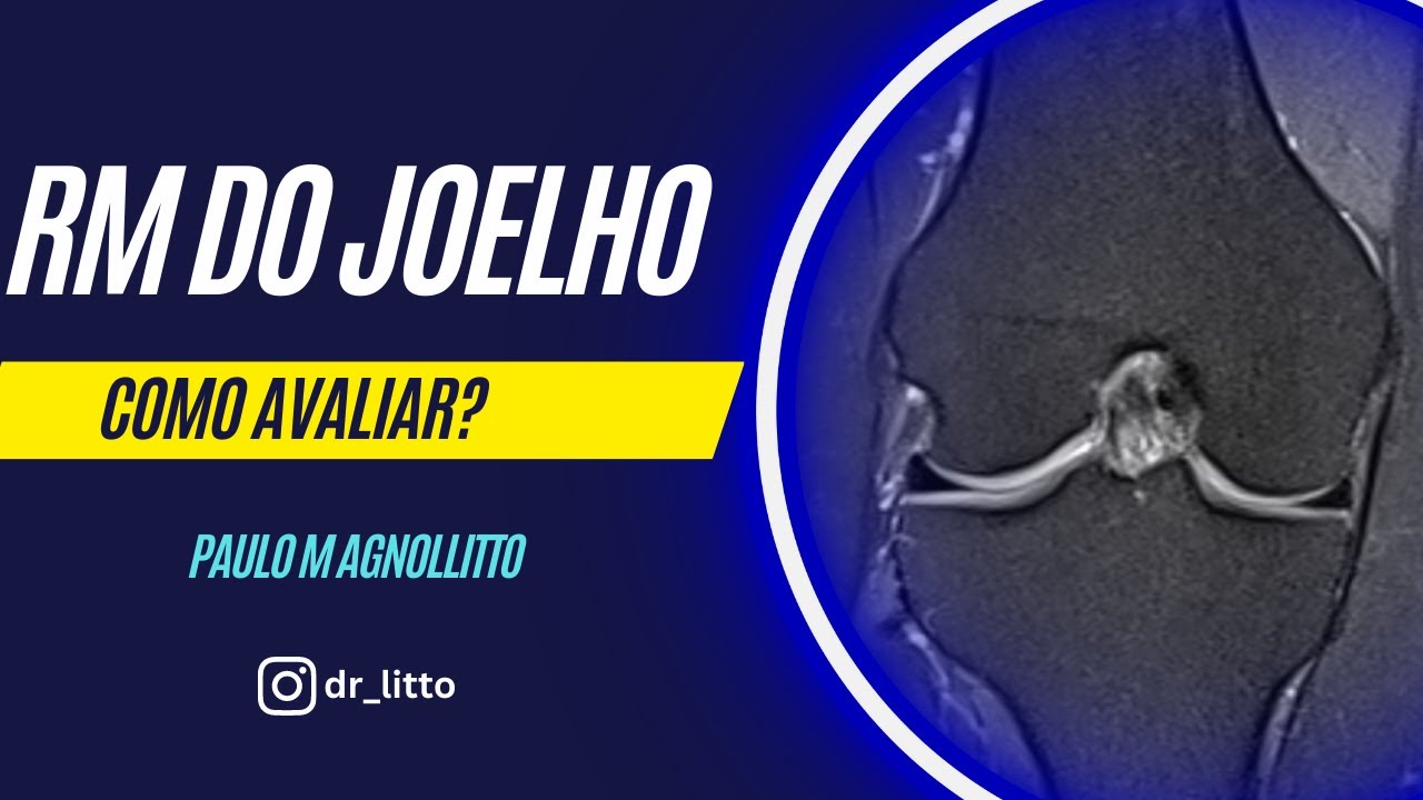 RM DO JOELHO: COMO AVALIAR?