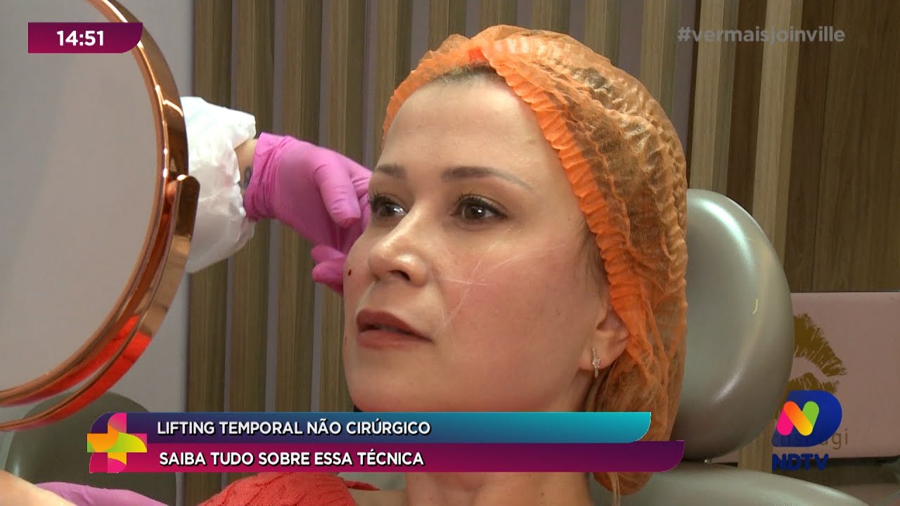 Lifting temporal não-cirúrgico: saiba tudo sobre essa técnica