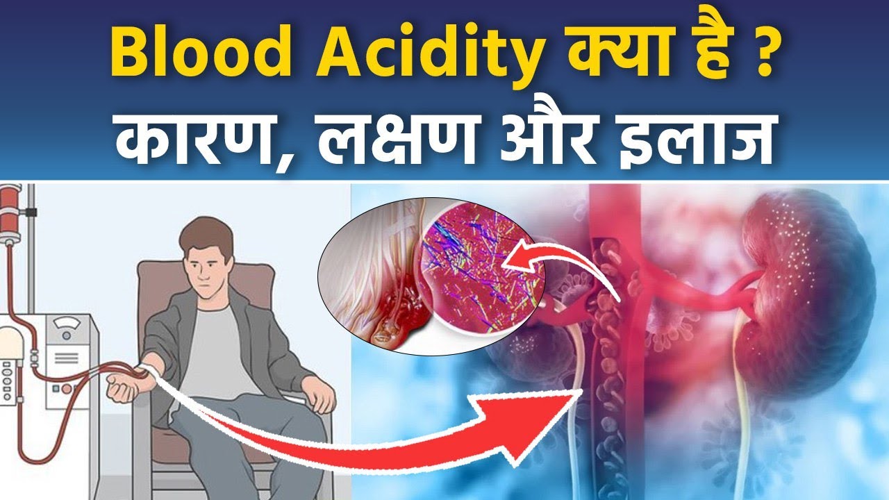 Blood Acidity Ko Kaise Theek Kare : Blood Me Acid Badhne Se Kya Hota Hai, Symptoms & Treatment