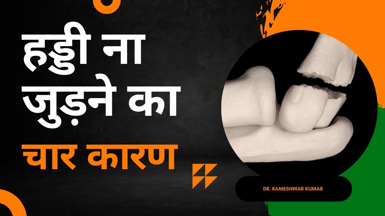 हड्डी ना जुड़ने के 4 कारण | what are the 4 reasons for bone not joining ||