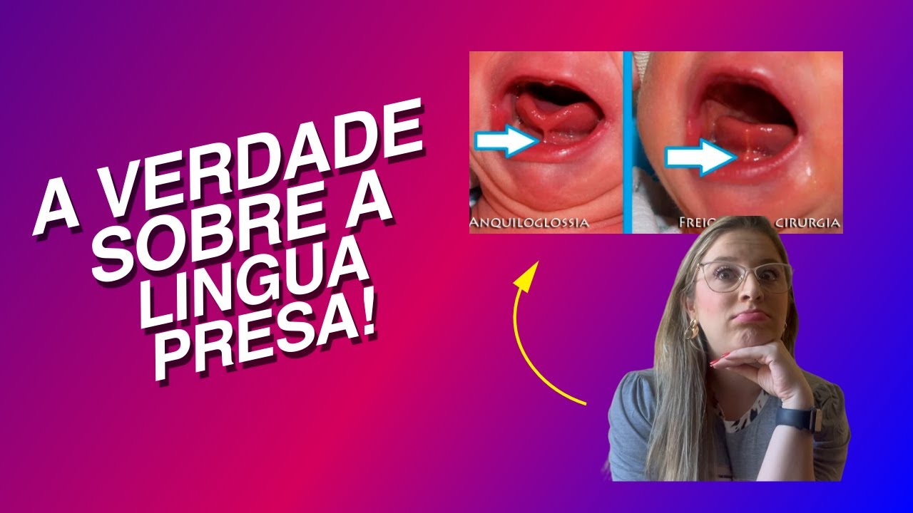 Língua Presa em Bebê: Nossa Experiência Completa