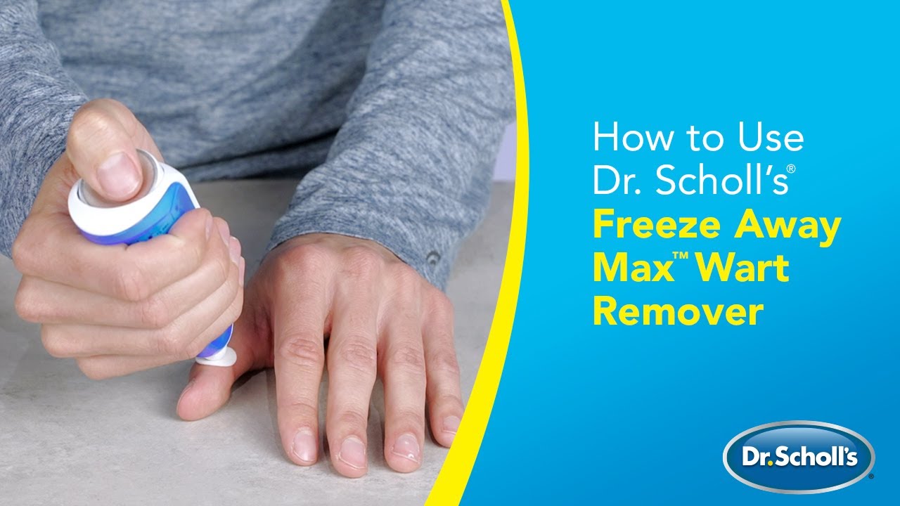 Dr. Scholl’s | How to Use Freeze Away Max™ Wart Remover
