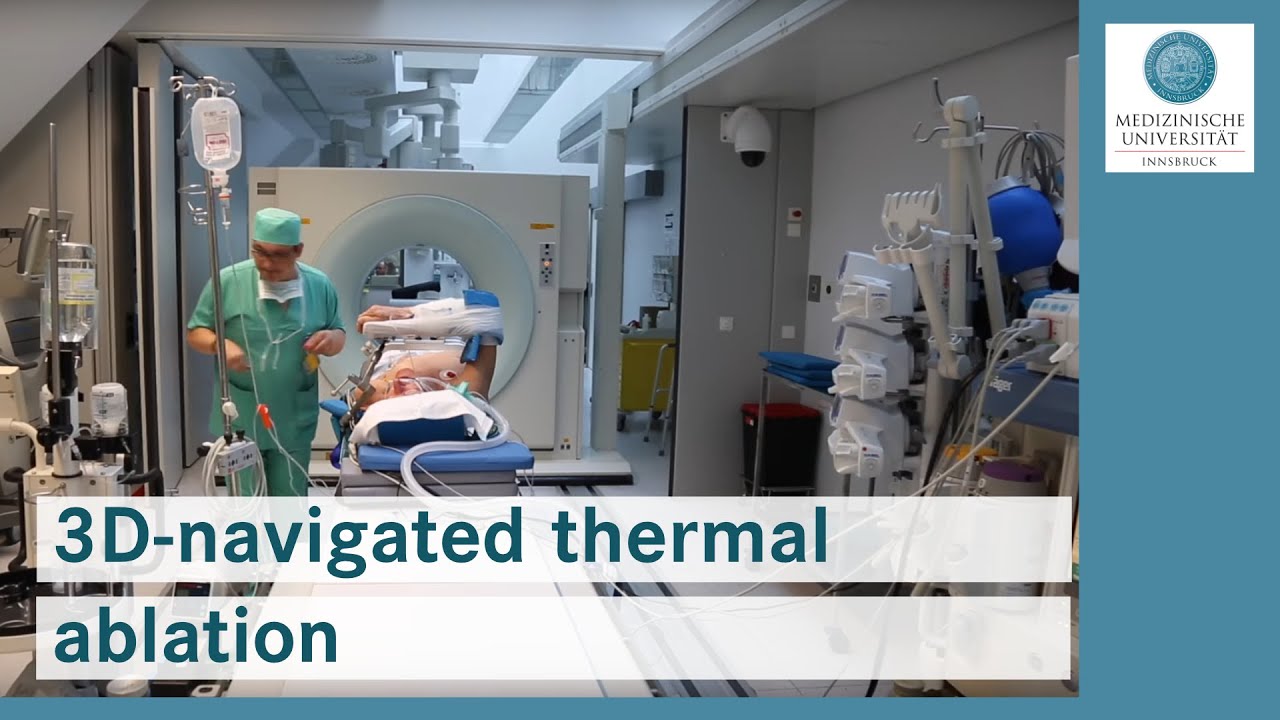 Effective treatment of cancer and metastases: 3D-navigated thermal ablation