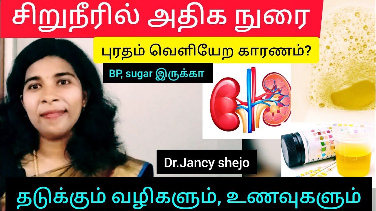 சிறுநீர் ல நுரை போகுதா# காரணம், தடுப்பது எப்படி, உணவு முறைகள்#proteinuria, causes, diet plan#dr