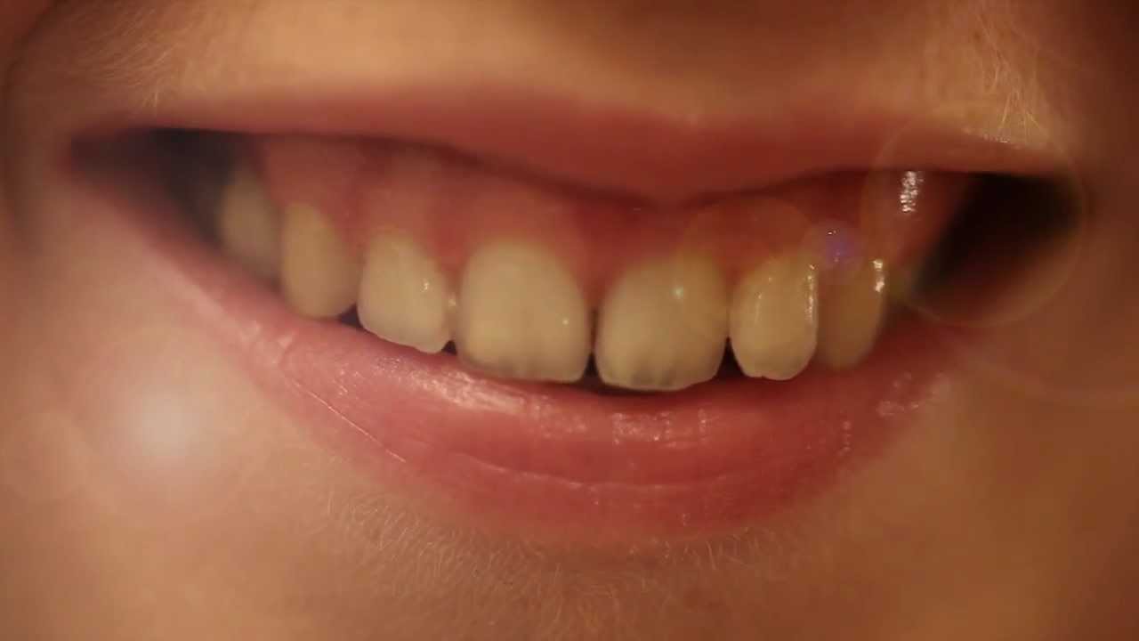Gemma Patient Testimonial
