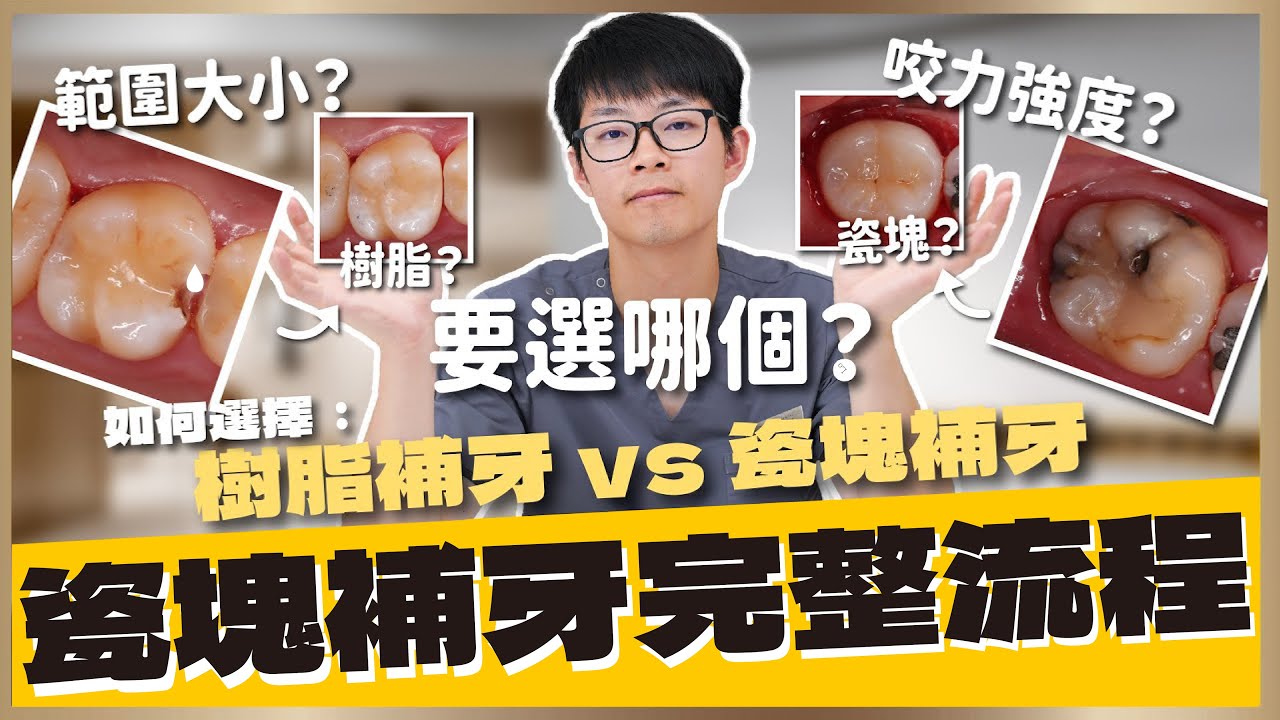 【蛀牙 #12】瓷塊補牙的治療流程！發生蛀牙的時候該選擇哪種治療方式？選擇樹脂還是瓷塊到底有什麼差別呢？｜【祐民牙醫－隱適美旗艦店】鑽石級楊大為醫師 #蛀牙 #瓷塊補牙 #樹脂補牙 #祐民牙醫
