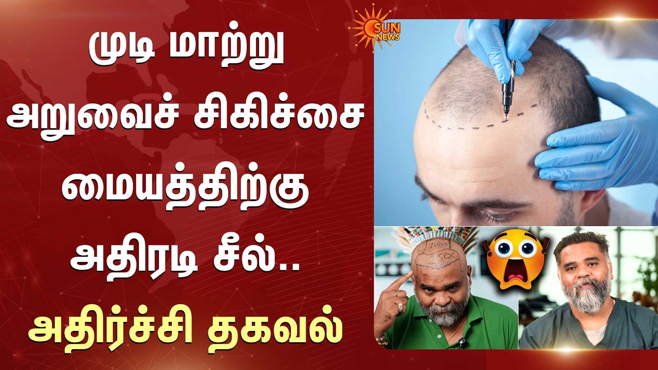 Mister Hair Clinic | Anna Nagar | Hair Transplant | Hair Loss | Hair Transplant Center Sealed
