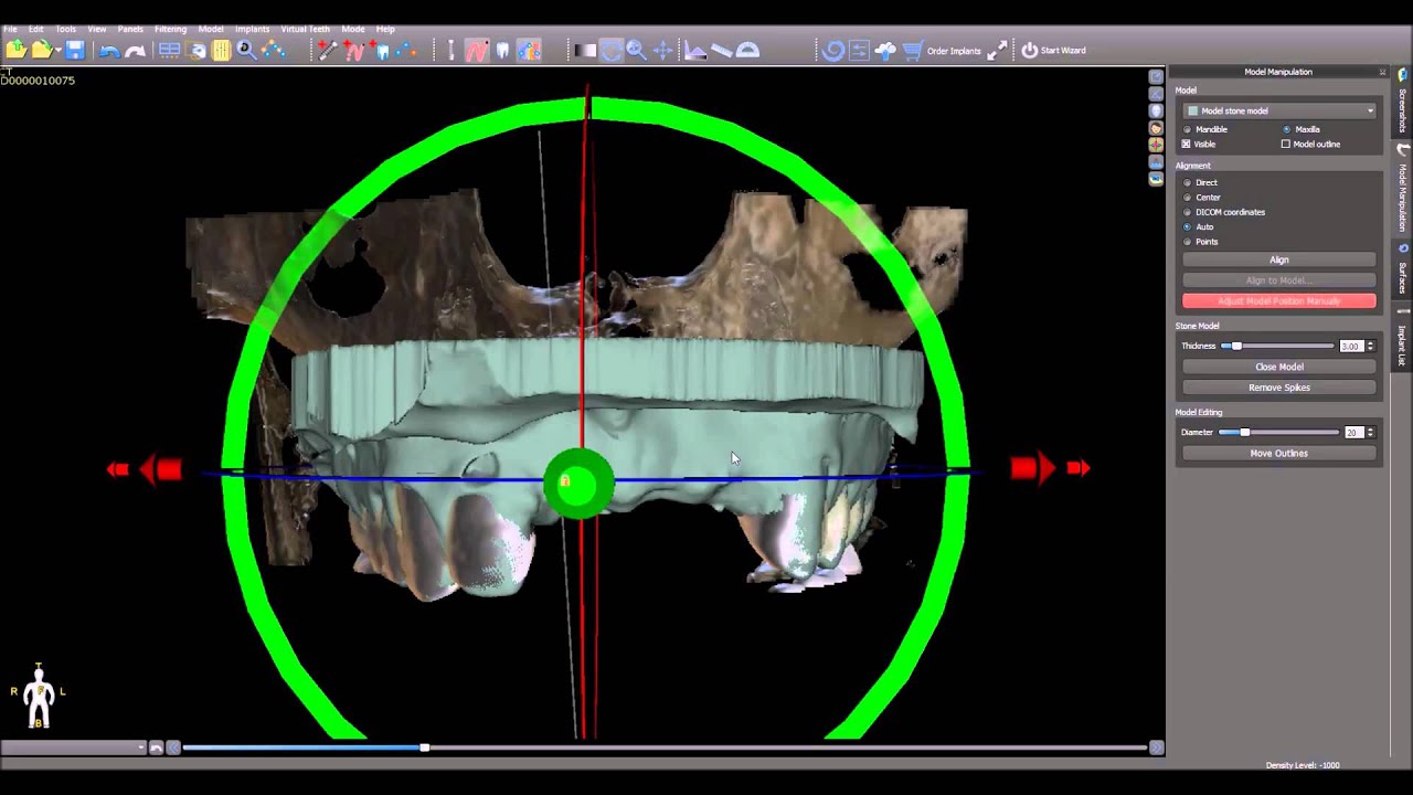 Blue Sky Plan Training Tutorial: Exact Arrow Control of Objects