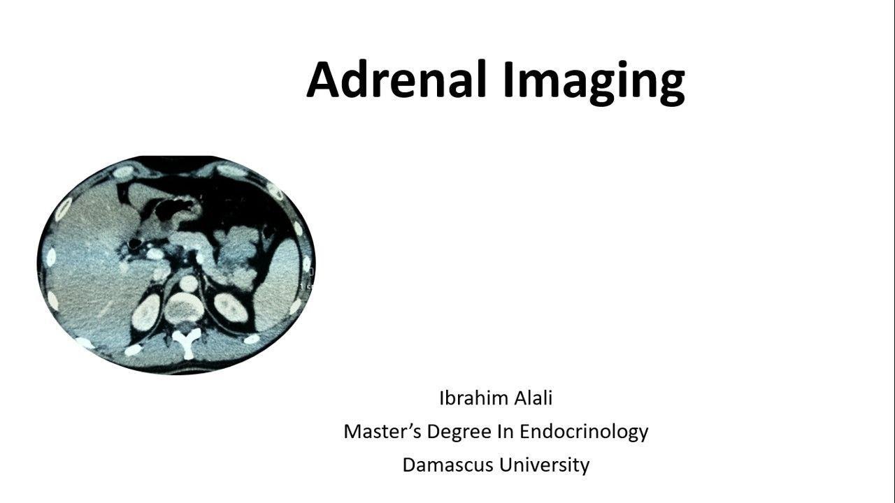 Adrenal Imaging by Ibrahim Alali