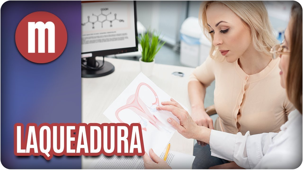 Saúde: laqueadura - Mulheres (04/12/17)