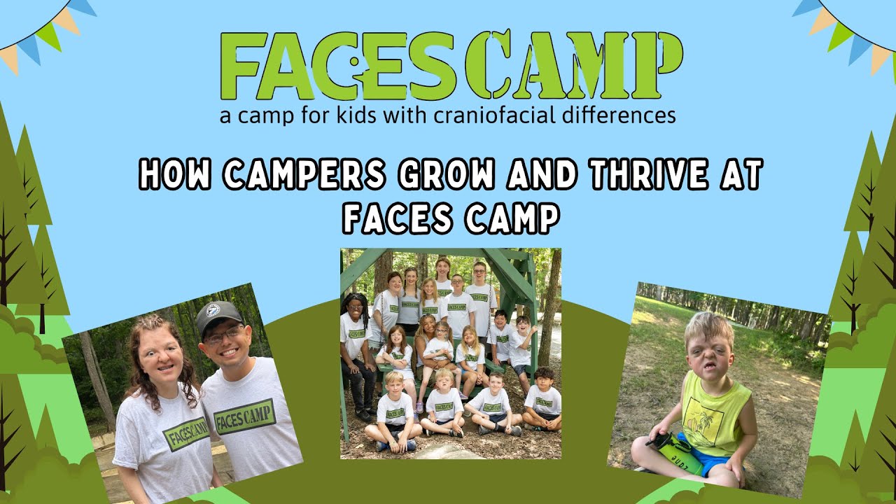 How Campers Grow and Thrive at FACES Camp