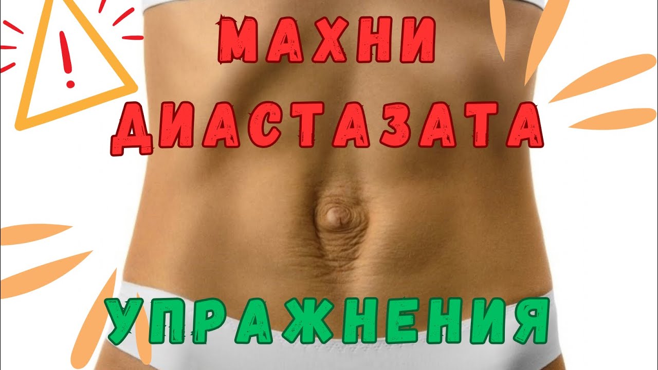 Упражнения за премахване на диастазата