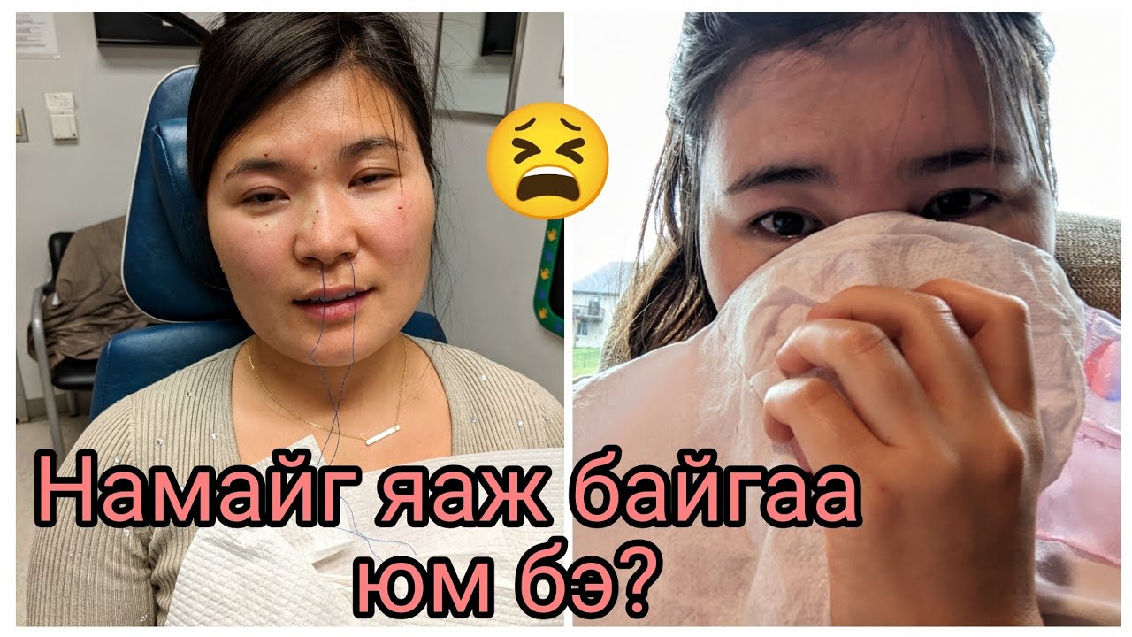 Хамар хугалчихлаа ш дээ! 😫😭