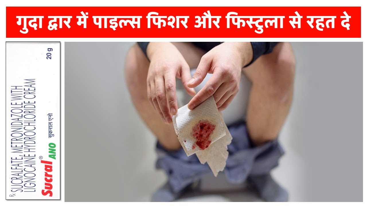 Sucral ANO | Lidocaine + Metronidazole  + Sucralfate | पाइल्स +फिशर + फिस्टुला + मॉल द्वार में जलन